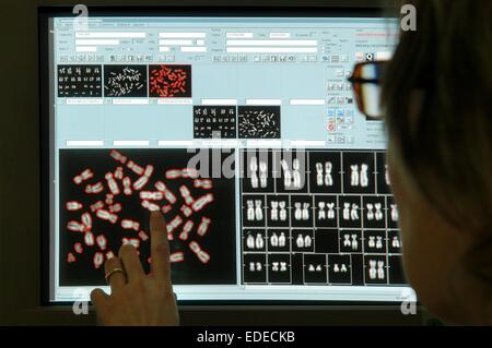 Università degli Studi di Milano (Italia), Dipartimento di Biologia e genetica, analisi dei cromosomi Foto Stock