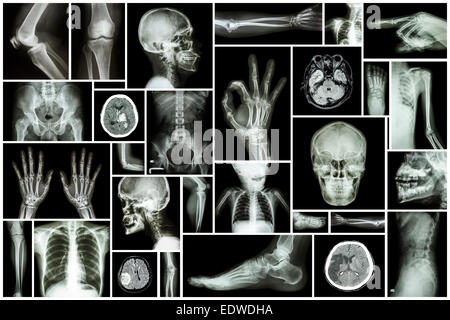 Collezione X-ray più parte dell'umana Foto Stock