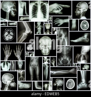 Collezione X-ray più parte dell'umana Foto Stock