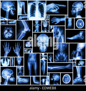 Collezione X-ray più parte dell'umana Foto Stock