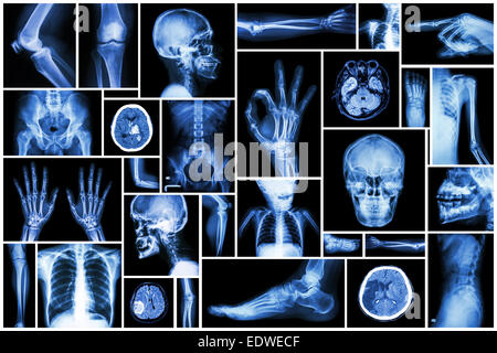 Collezione X-ray più parte dell'umana Foto Stock