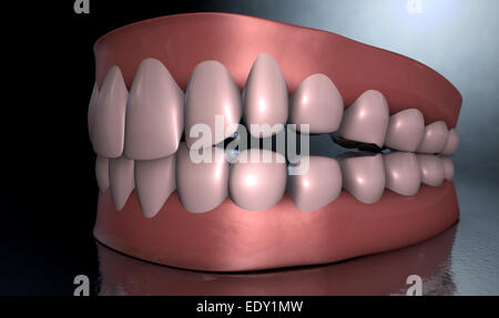 Un sinistro drammatica rappresentazione di seperated superiore e inferiore di gruppi di denti umani nel set di gomme al buio su un inquietante sfondo spotlit Foto Stock