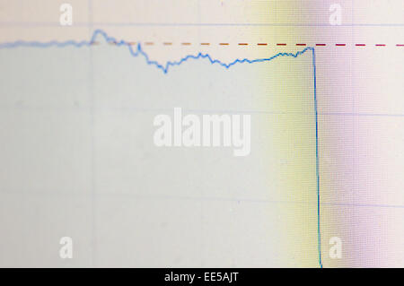 Una brusca caduta di Grafico azionario per finanziare concetto. Foto Stock