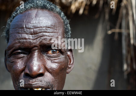 L'uomo appartenenti alla tribù Nuer con tradizionale scarifications sulla fronte. Egli è un rifugiato dal sud Sudan (Etiopia) Foto Stock