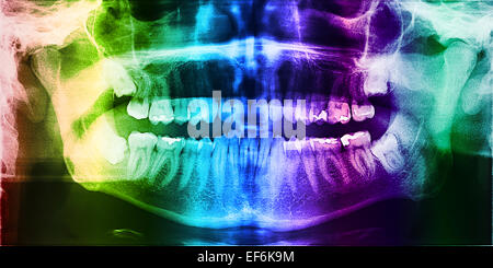 Apparecchiature odontoiatriche a raggi X e la foto del teschio umano con denti Foto Stock