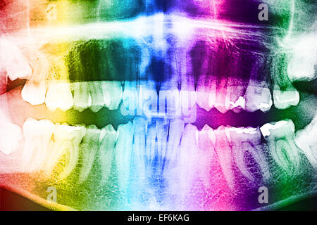 Apparecchiature odontoiatriche a raggi X e la foto del teschio umano con denti Foto Stock