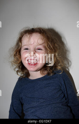 Una giovane e bella tre-anno-vecchia ragazza con la varicella, raffigurato nella sua casa di West Sussex, Regno Unito. Foto Stock