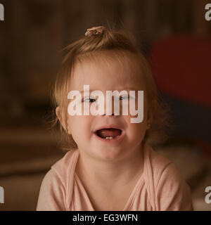 Le emozioni di una bambina con la sindrome di Down Foto Stock