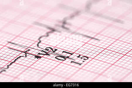 Ravvicinata di un elettrocardiografo in carta Foto Stock