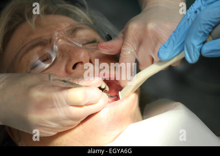 Donna al dentista - modello rilasciato Foto Stock