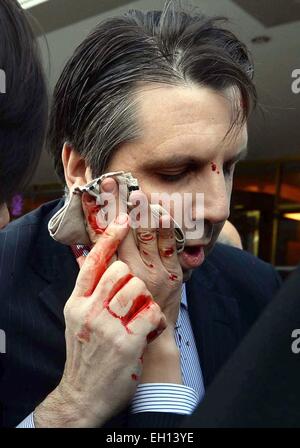 Seoul, Corea del Sud. Mar 5, 2015. Stati Uniti Ambasciatore di Corea del Sud Mark Lippert è ferito da una lama-wielding utente malintenzionato a Seul, Corea del Sud, 5 marzo 2015. Credito: Newsis/Xinhua/Alamy Live News Foto Stock