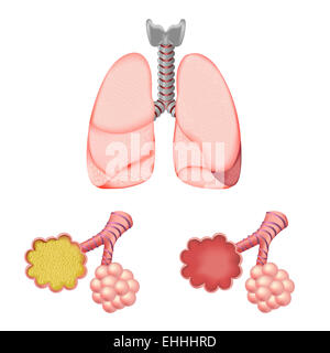 Alveoli In e nei polmoni Foto Stock