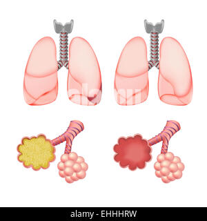 Alveoli in polmoni impostato Foto Stock