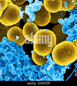 Color scanning electron microfotografia (SEM) di Staphylococcus aureus resistente alla meticillina (MRSA) batteri. Foto Stock