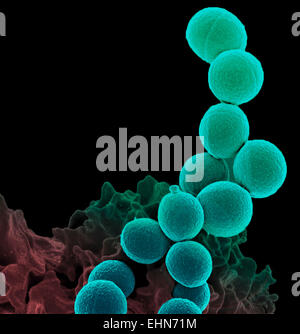 Color scanning electron microfotografia (SEM) di un neutrofilo globuli bianchi (fondo) travolgendo Staphylococcus aureus resistente alla meticillina batteri (MRSA, giallo). Foto Stock