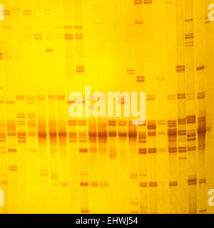 Impianto di impronte digitali di DNA su gel acrylamine risultato di elettroforesi Foto Stock