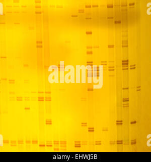 Impianto di impronte digitali di DNA su gel acrylamine risultato di elettroforesi Foto Stock
