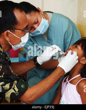 Esercito filippino Capt. Daniel de Vera sinistra, un dentista con la VII divisione di fanteria di distacco dentale, tira un dente dolorante dalla bocca di Maricris, 9, con l'assistenza di U.S. Army Spc. Analuz Garcia, un odontotecnico con lo stato comando medici, Guam Esercito Nazionale Guardia, durante un dentista civic programma di assistenza nel Santa Rosa comune Feb. 22 come parte di Balikatan 2008. Sgt. Stephen Proctor Foto Stock