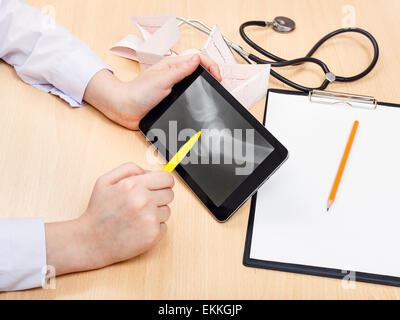 Medico esamina X-ray immagine dell'articolazione del ginocchio umano su tablet pc Foto Stock