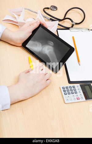 Medic esamina X-ray immagine dell'articolazione del ginocchio umano su tablet pc Foto Stock