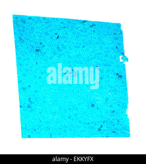 Vicia dicotiledone foglie sotto un microscopio (Vicia dicotiledone leaf W.M.), 40x Foto Stock