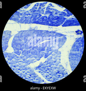 Muscolo liscio taquiné preparazione sotto un microscopio, muscolo liscio W.M., 400x Foto Stock