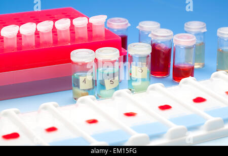 Array di campioni di sangue per microscopia e biopsia di tessuto su blu Foto Stock