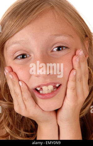 Un grazioso 8 anno vecchia ragazza mantenendo entrambe le mani sul suo volto, mostrando il suo denti mancanti, isolato per sfondo bianco. Foto Stock