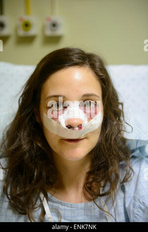 Giovane donna con bende sul viso mentre il recupero da un naso lavoro (rinoplastica) su un letto di ospedale Foto Stock