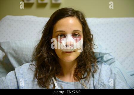 Giovane donna con bende sul viso mentre il recupero da un naso lavoro (rinoplastica) su un letto di ospedale Foto Stock