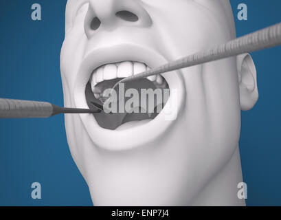 Illustrazione dell'uomo con apparecchiature dentali in bocca su sfondo blu Foto Stock