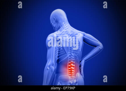 Digital blu sfregamento umana sono evidenziati in rosso i dolori alla parte inferiore della schiena Foto Stock