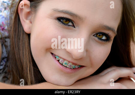 Una graziosa adolescente closeup con rinforzi su i suoi denti. Foto Stock