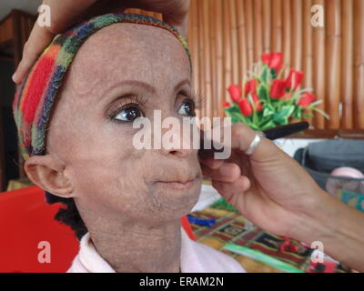 Bulacan nelle Filippine. Il 30 maggio 2015. Ana Pondare Rochelle, la ragazza con rare condizioni di maturazione noto come progeria spire 18 su 30 Maggio, 2015. I bambini con progeria ha 13 - 15 durata ma sette anni fa il dottor Pierre R. Clero, un chirurgo, aiutato Pondare per prolungare la sua vita. Il dott. Clero progettato una medicina per la Rochelle, ha dato la sua dieta speciale e creme per la pelle per quasi un anno fino a quando il Dr. Clero migrato e Progeria Research Foundation e il progetto Michelangelo Foundation è venuto per la vita di Rochelle per prolungare la durata della sua vita. Credito: Sherbien Dacalanio/Alamy Live News Foto Stock