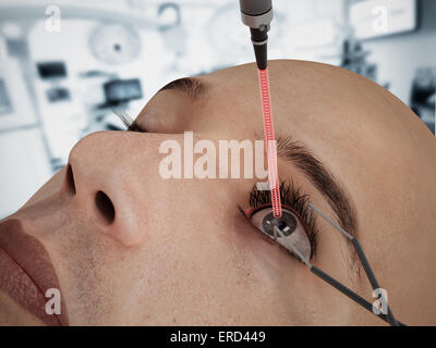 La chirurgia dell'occhio del laser sul 3D carattere CGI. Foto Stock