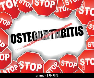 Illustrazione Vettoriale di smettere di osteoartrite concetto sfondo Illustrazione Vettoriale