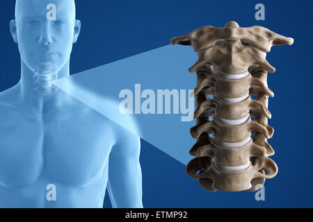 Stilizzata illustrazione che mostra le vertebre del collo in situ, con una ridotta sezione per mostrare le vertebre cervicali più in dettaglio. Foto Stock