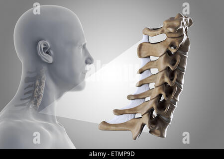 Stilizzata illustrazione che mostra le vertebre del collo in situ, con una ridotta sezione per mostrare le vertebre cervicali più in dettaglio. Foto Stock