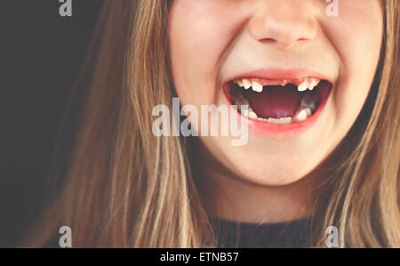 Close-up di un gap ragazza dentata ridere Foto Stock