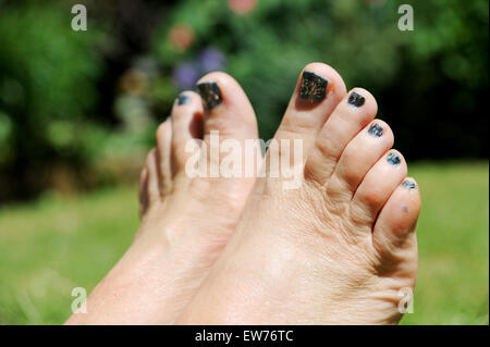 La salute e la bellezza della donna con dipinti di glitter unghie dei piedi per l'estate a prendere il sole in giardino Foto Stock