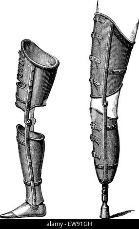 Gambe artificiali, mostrato con piede (sinistra) e con pestello (a destra), vintage illustrazioni incise. Al solito Dizionario medicina dal dr. Illustrazione Vettoriale