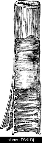 Struttura del piccolo intestino, vintage illustrazioni incise. Al solito Dizionario medicina dal dr. Labarthe - 1885 Illustrazione Vettoriale