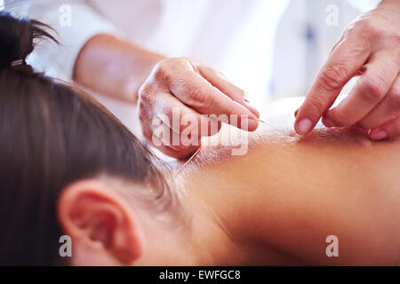 Close up medico agopuntore applicando aghi di agopuntura per donna di collo Foto Stock