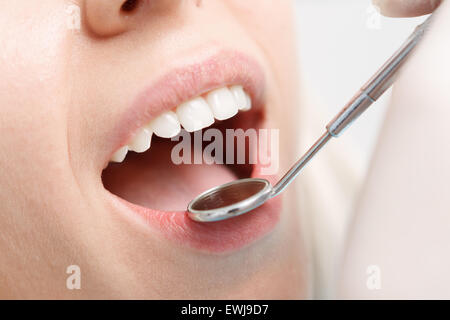 Close-up di donna con i suoi denti esaminati Foto Stock