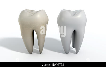 Un confronto tra un macchiato dente sporco e pulire un dente bianco su un isolato di sfondo per studio Foto Stock