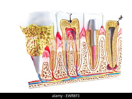 Sezione dentale modello, denti sfondo anatomico. Foto Stock