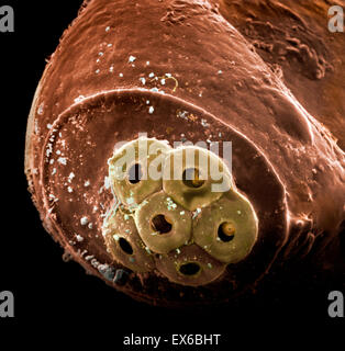 Pediculus humanus capitis, testa pidocchio del dettaglio di uovo, SEM Foto Stock
