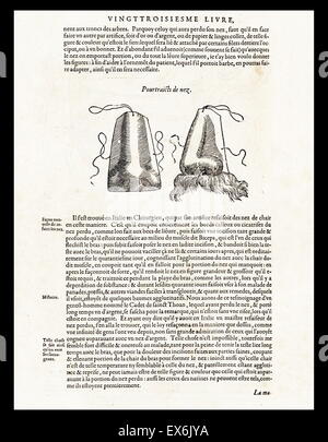 Illustrazione da 'Les oeuures d'Ambroise pare?" 1585 da Ambroise pare?, 1510-1590 chirurgo francese e anatomista Foto Stock