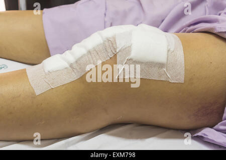 La chirurgia di sostituzione del ginocchio dopo operazione paziente donna senior (60s) sul letto in ospedale
