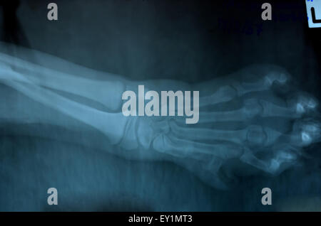 X ray foto di animale selvatico scheletro Foto Stock